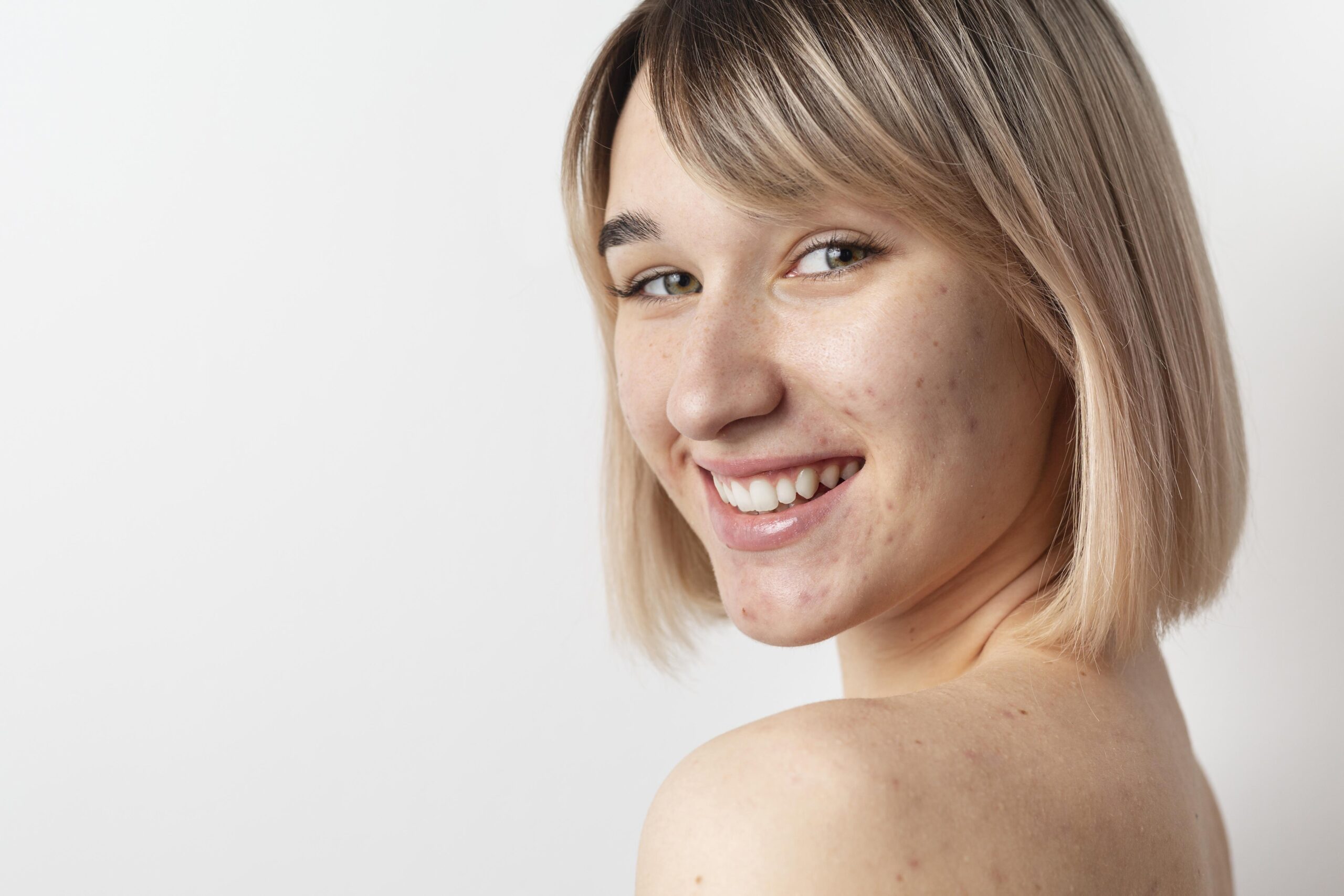 Ducray Keracnyl, il siero per imperfezioni ricorrenti e segni post-acne